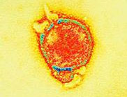 Hendra virus